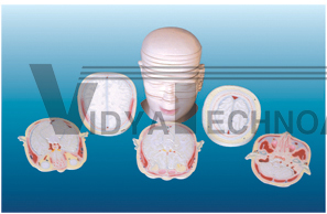 The model of plana section with head (17pcs)